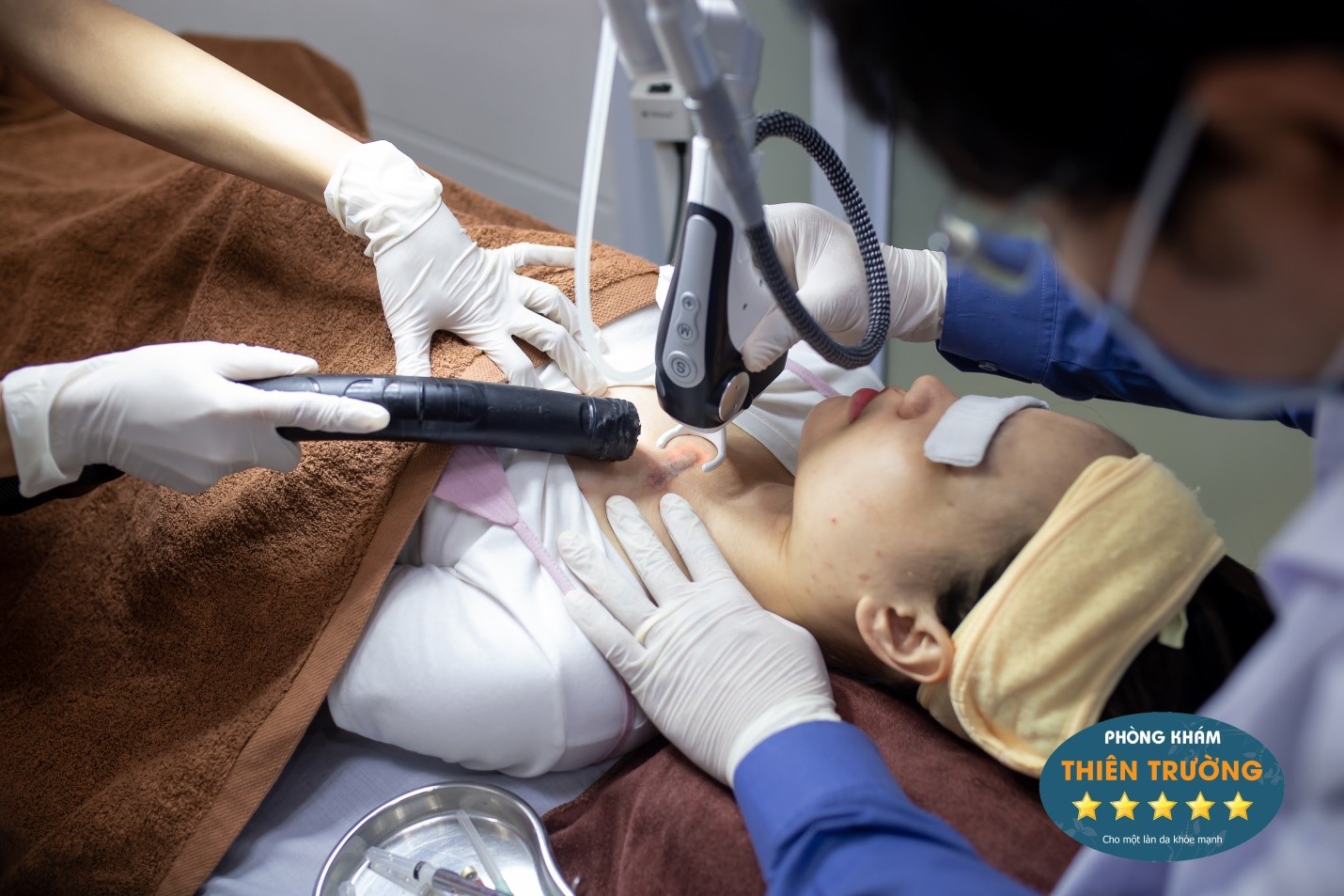 Quá trình điều trị sẹo lồi Hình ảnh: Quá trình điều trị sẹo lồi