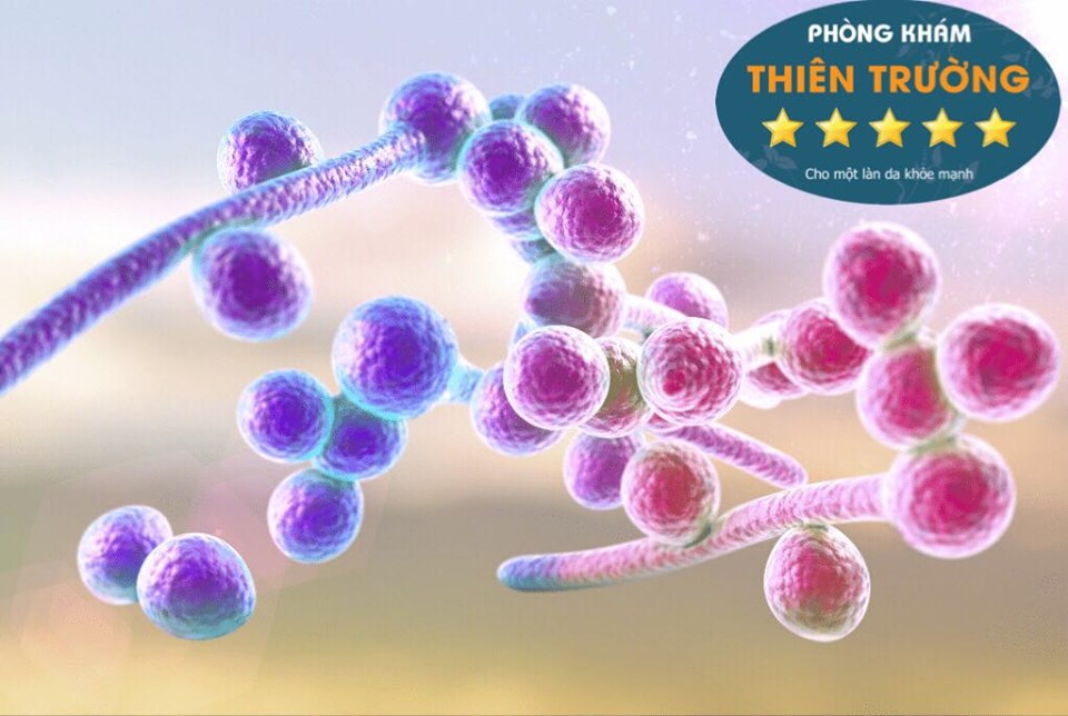 Hình ảnh minh họa Nấm Candida Hình ảnh: Nấm sinh dục Candida