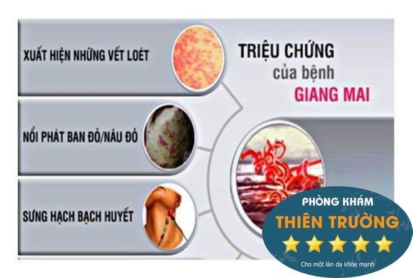 Hình ảnh: Triệu chứng bệnh giang mai