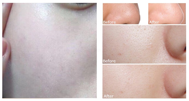 thu nho lo chan long