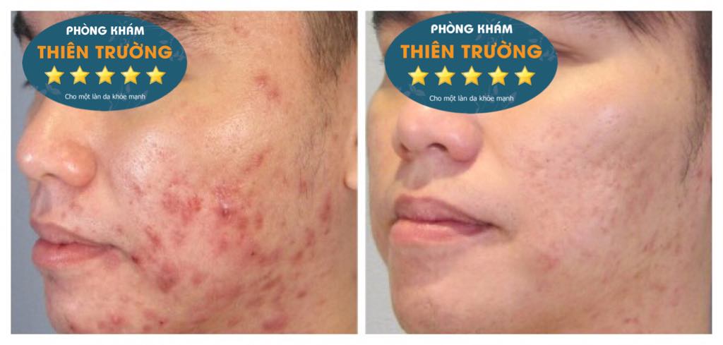 Khách hàng sau khi được hỗ trợ điều trị Khách hàng sau khi được hỗ trợ điều trị