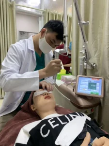 Hình ảnh : bác sĩ đang điều trị tàn nhang