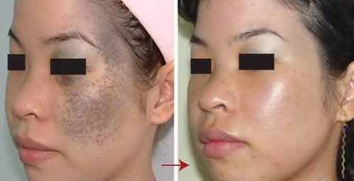 Hình ảnh: Trước và sau khi được hỗ trợ điều trị