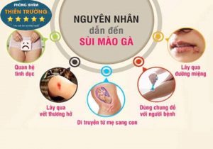 Hình ảnh: Nguyên nhân dẫn đến sùi mào gà.