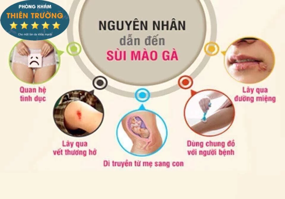 Hình ảnh: Nguyên nhân dẫn đến bệnh sùi mào gà.
