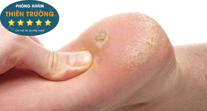 Hình ảnh: Hạt cơm