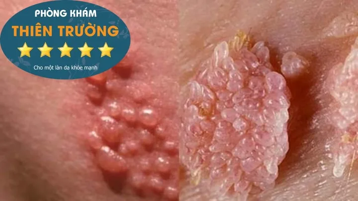 71141194_746132392491120_1850835307746820096_n