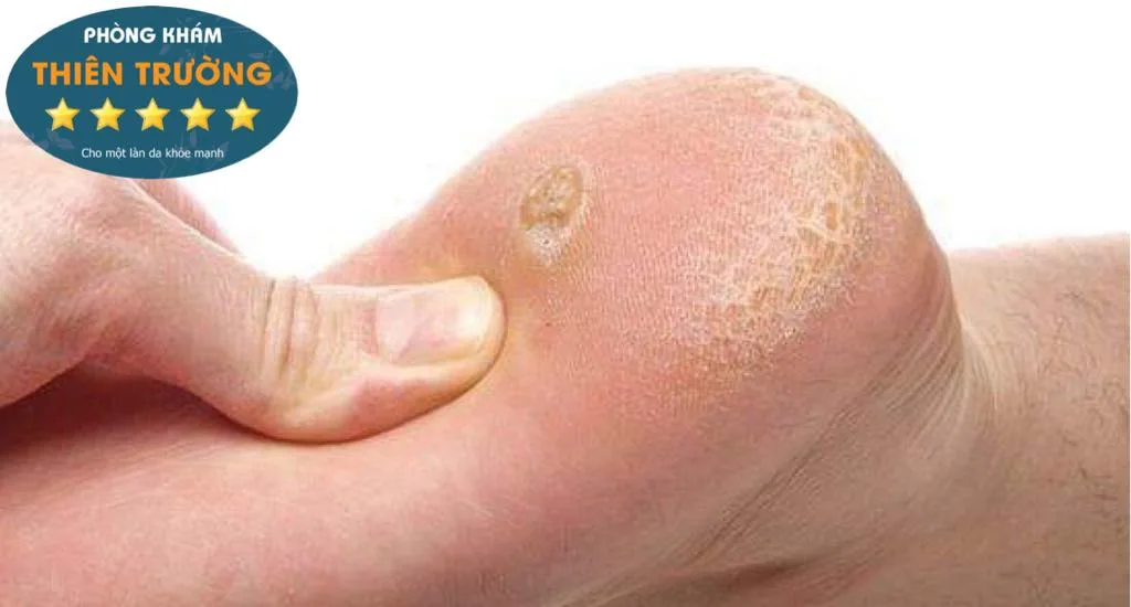 Hình ảnh: Hạt cơm