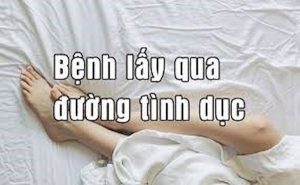 Hình ảnh: Bệnh lây qua đường tình dục.