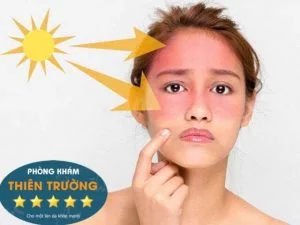 Hình ảnh: Ánh nắng mặt trời gây tình trạng khô da.