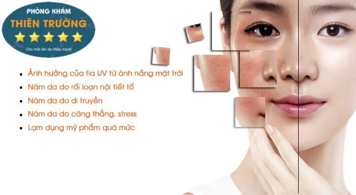 Hình ảnh: Các nguyên nhân cơ bản hình thành nám