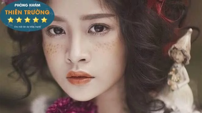 Hình ảnh: Tàn nhang, nỗi lo của bao chị em phụ nữ