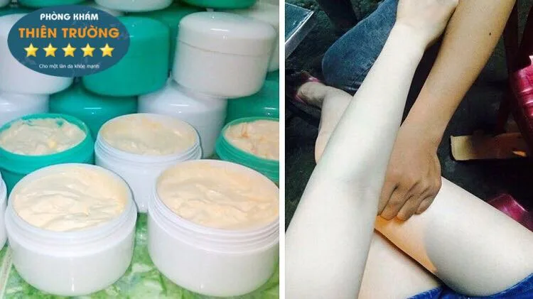 Hình ảnh: Kem trộn làm trắng da nhanh, không vàng lông