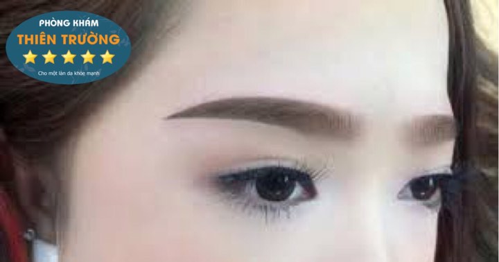 Hình ảnh: Phun mày