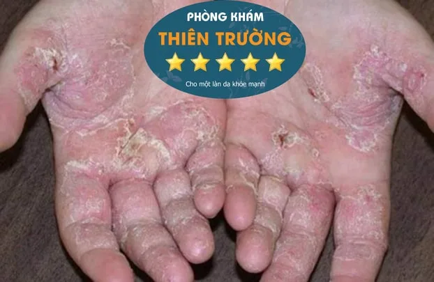 71545438_767342647036809_8464760488872378368_n