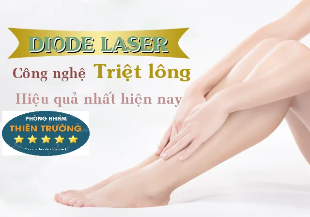 Hình ảnh: Triệt lông công nghệ Diode laser