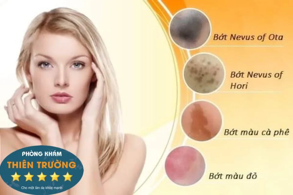 Hình ảnh: Phân loại bớt sắc tố.