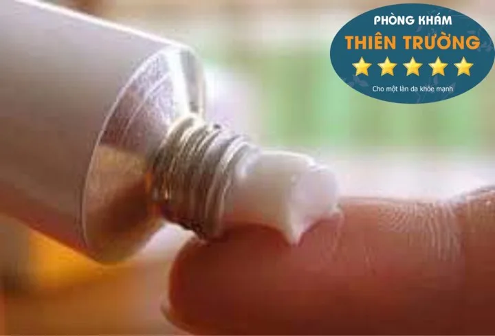 Hình ảnh: Nên sử dụng kem trị mụn theo sự hướng dẫn của bác sĩ da liễu. 