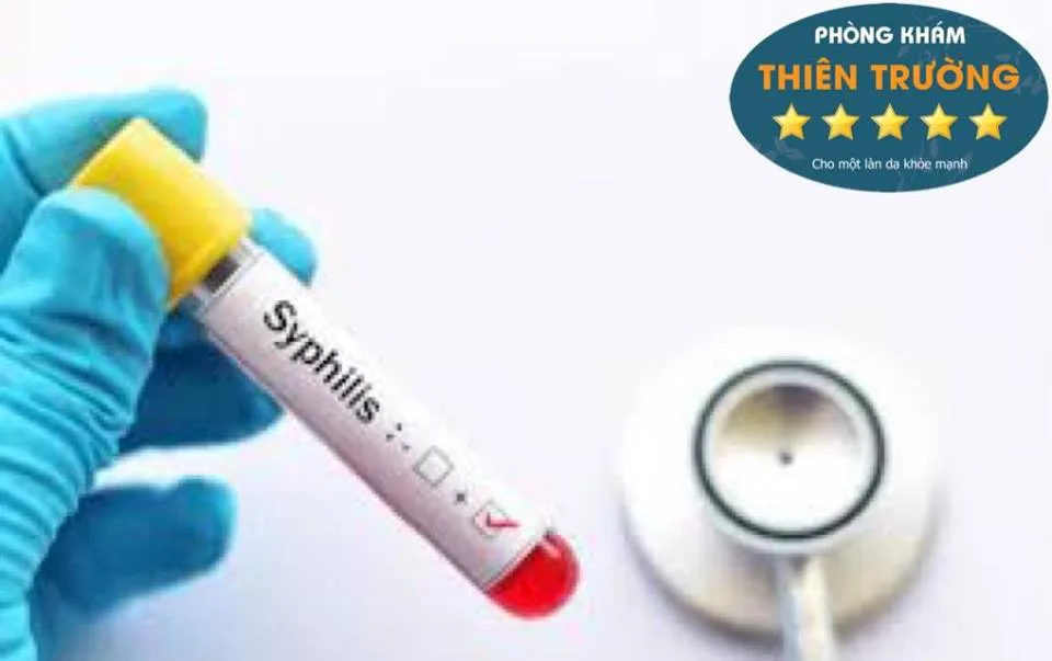 Hình ảnh: Xét nghiệm để phát hiện bệnh