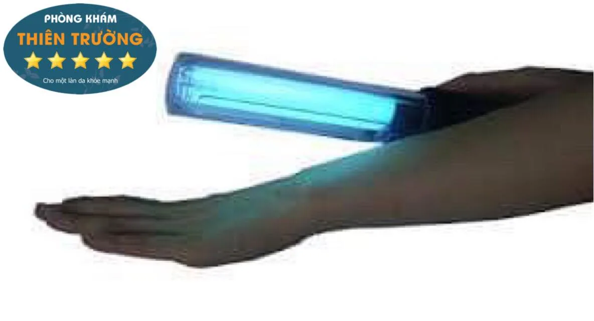 Hình ảnh: Hỗ trợ điều trị bạch biến bằng quang trị liệu