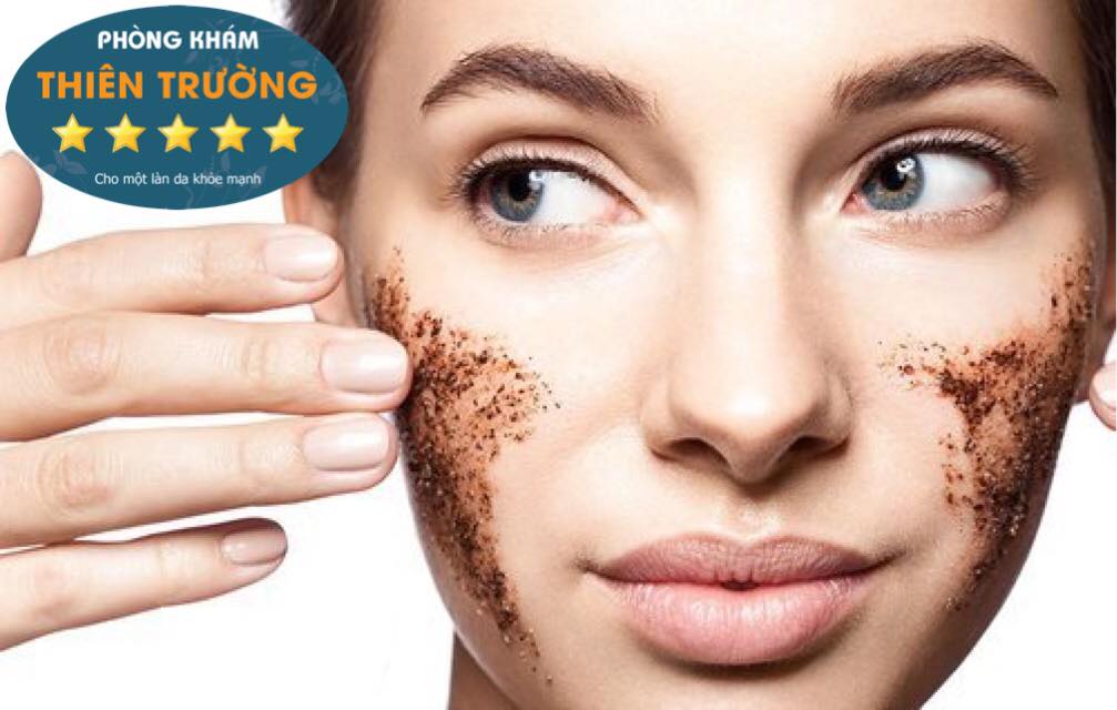 Hình ảnh: Trị nám bằng bã cà phê