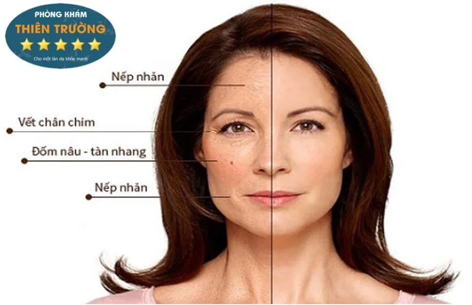 Hình ảnh: Lão hóa da theo thời gian