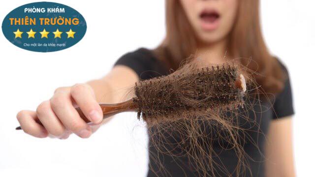 Hình ảnh: Nấm da đầu gây ra hiện tượng rụng tóc nhiều