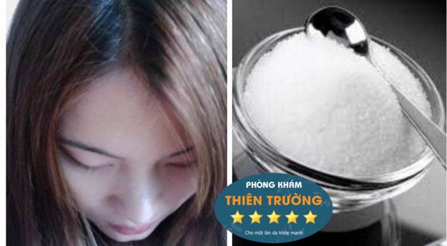 Hình ảnh: Hỗ trợ điều trị nấm da đầu bằng nước muối
