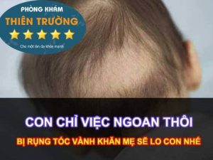Hình ảnh: Rụng tóc vành khăn