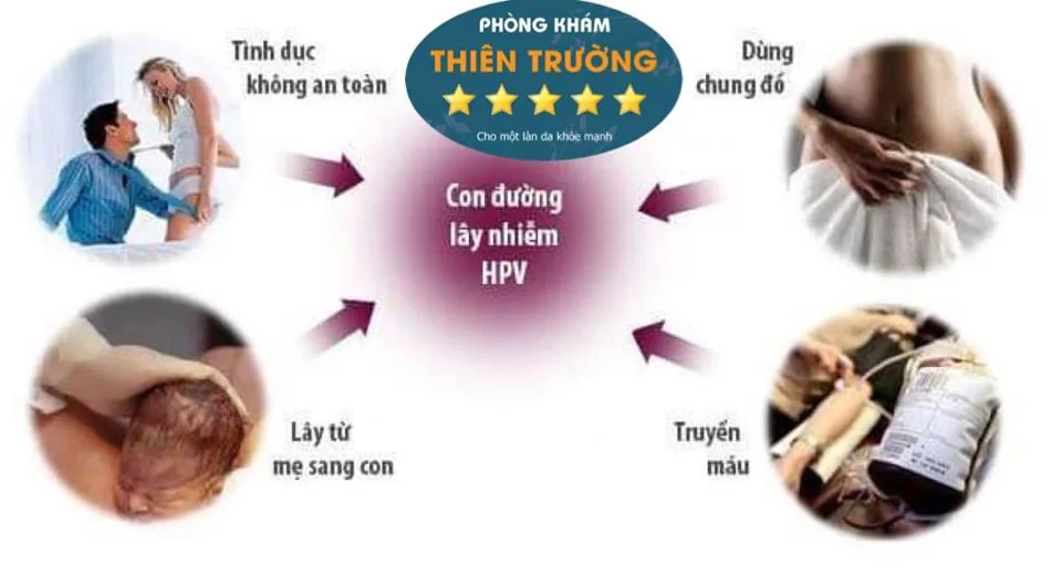 Hình ảnh: Con đường lây nhiêm HPV