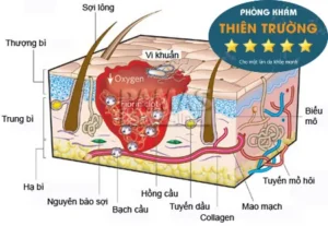 Hình ảnh: Tuyến mồ hôi nách
