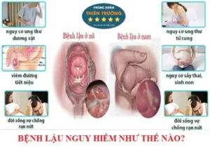 Hình ảnh: Bệnh lậu nguy hiểm như thế nào?