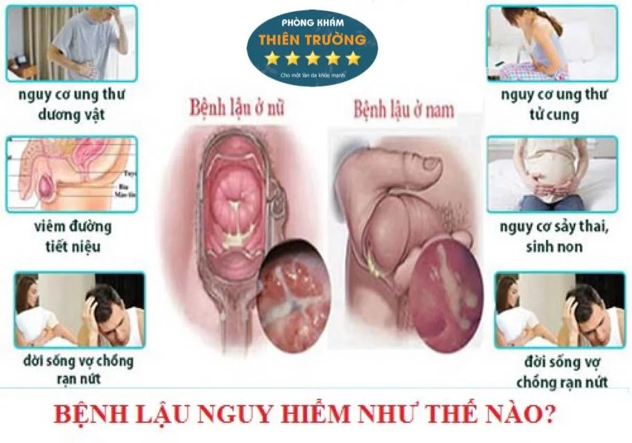 Hình ảnh: Bệnh lậu nguy hiểm như thế nào?