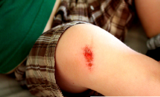 Cach-tri-seo-tham-do-nga-xe-1