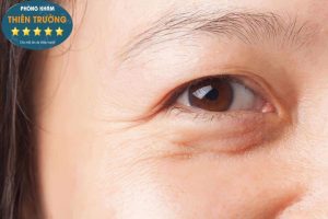 Hình ảnh: Rãnh nhăn và nếp nhăn