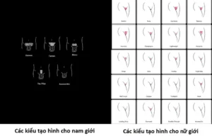 Hình ảnh: Tạo hình triệt lông vùng kín