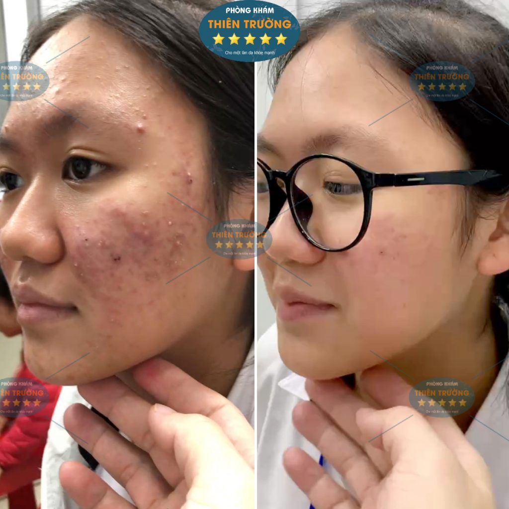 Hình ảnh : Bệnh nhân đã điều trị tại phòng khám