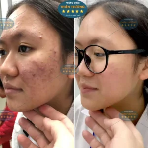 Hình ảnh : Bệnh nhân đã điều trị tại phòng khám