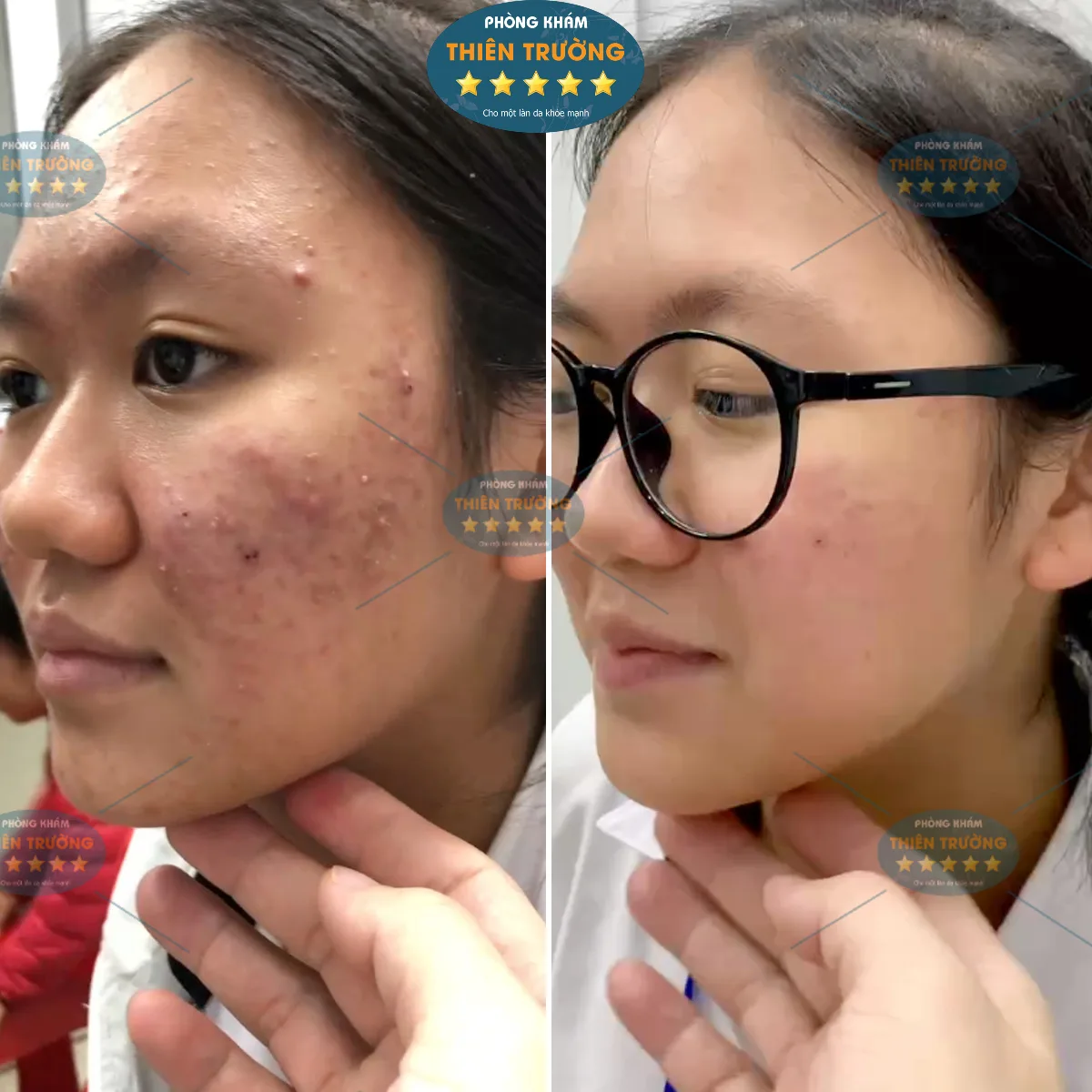 Hình ảnh : Bệnh nhân đã điều trị tại phòng khám