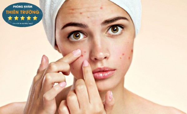 Hình ảnh: Thâm do nặn mụn sai cách cách