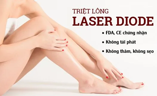 Hình ảnh: Triệt lông côgn nghệ Laser Diode.