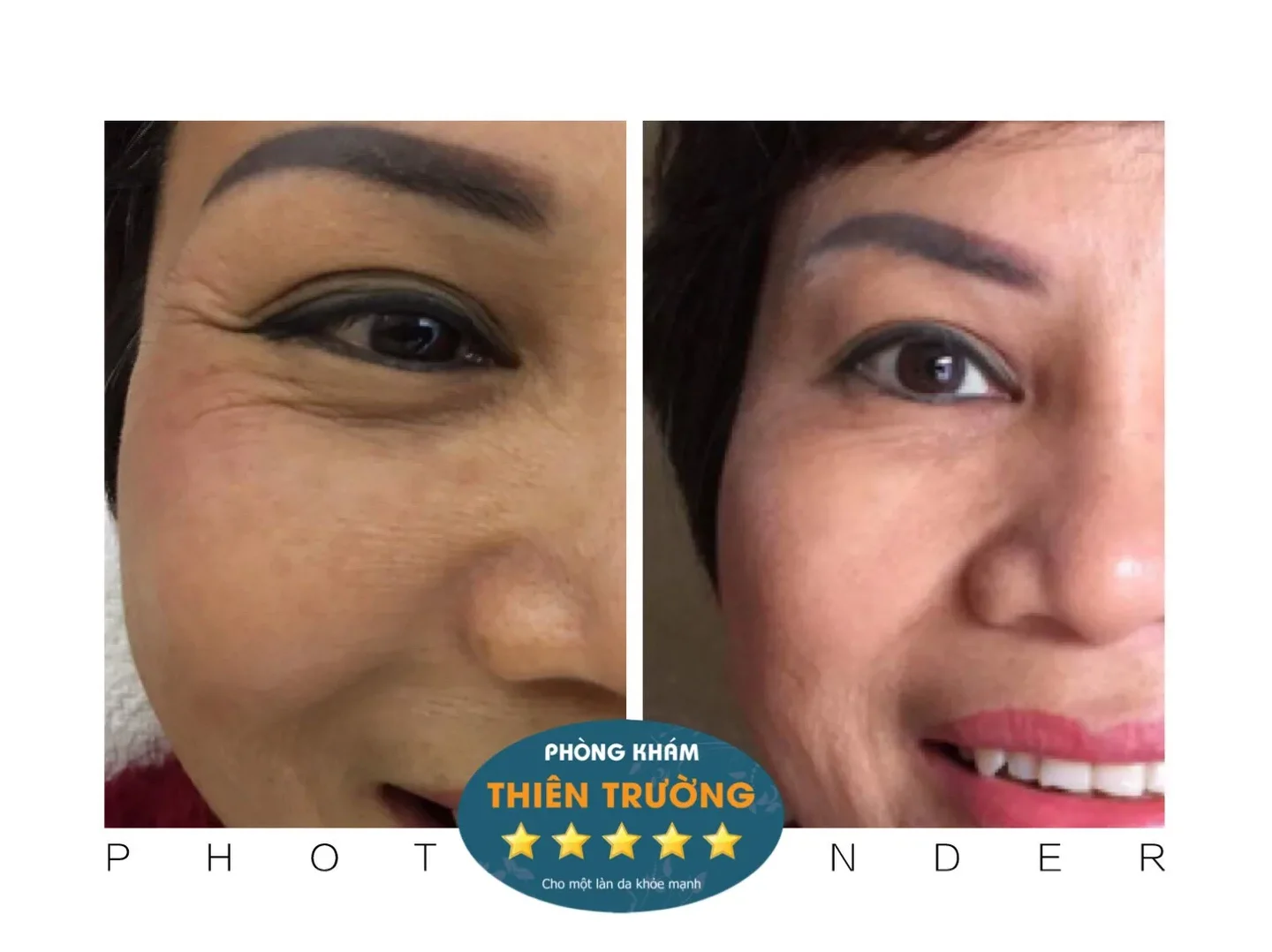 Hình ảnh: Lão hóa giảm bớt sau hỗ trợ điều trị