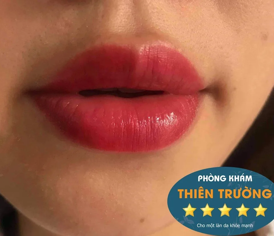 Hình ảnh: Khách hàng phun môi sau 2 tháng
