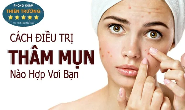 Hình ảnh: Hỗ trợ điều trị thâm mụn