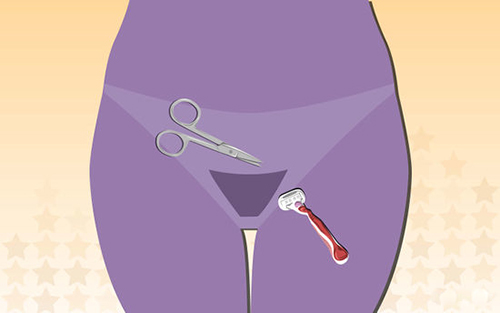 triệt lông vùng kín