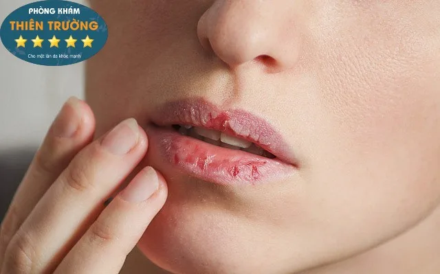 Hình ảnh: Tẩy da chết cho môi.