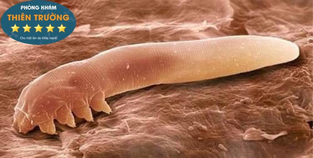 Hình ảnh: Demodex dưới kính hiển vi