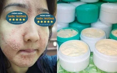 Hình ảnh: Sử dụng kem trộn