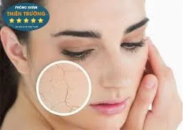 Hình ảnh: chăm sóc da khô