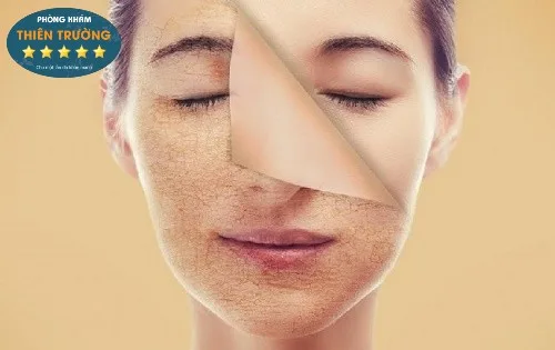 Hình ảnh: Lớp tế bào da chết